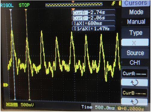 可穿戴技術(shù)在醫(yī)學(xué)領(lǐng)域遍地生花:脈搏血氧計問世