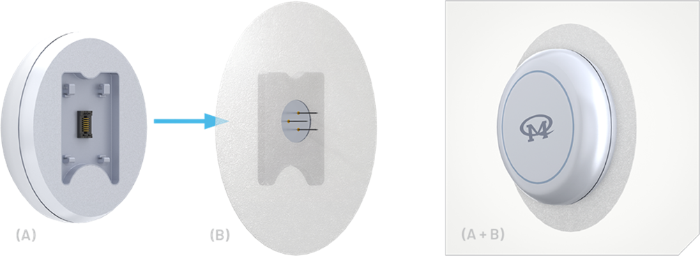 如何使用動(dòng)態(tài)血糖監(jiān)測(cè)設(shè)備(CGM)管理糖尿病 如何使用動(dòng)態(tài)血糖監(jiān)測(cè)設(shè)備(CGM)管理糖尿病